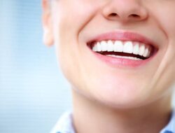 Bleaching dan Veneer Gigi, Bolehkah dalam Islam?